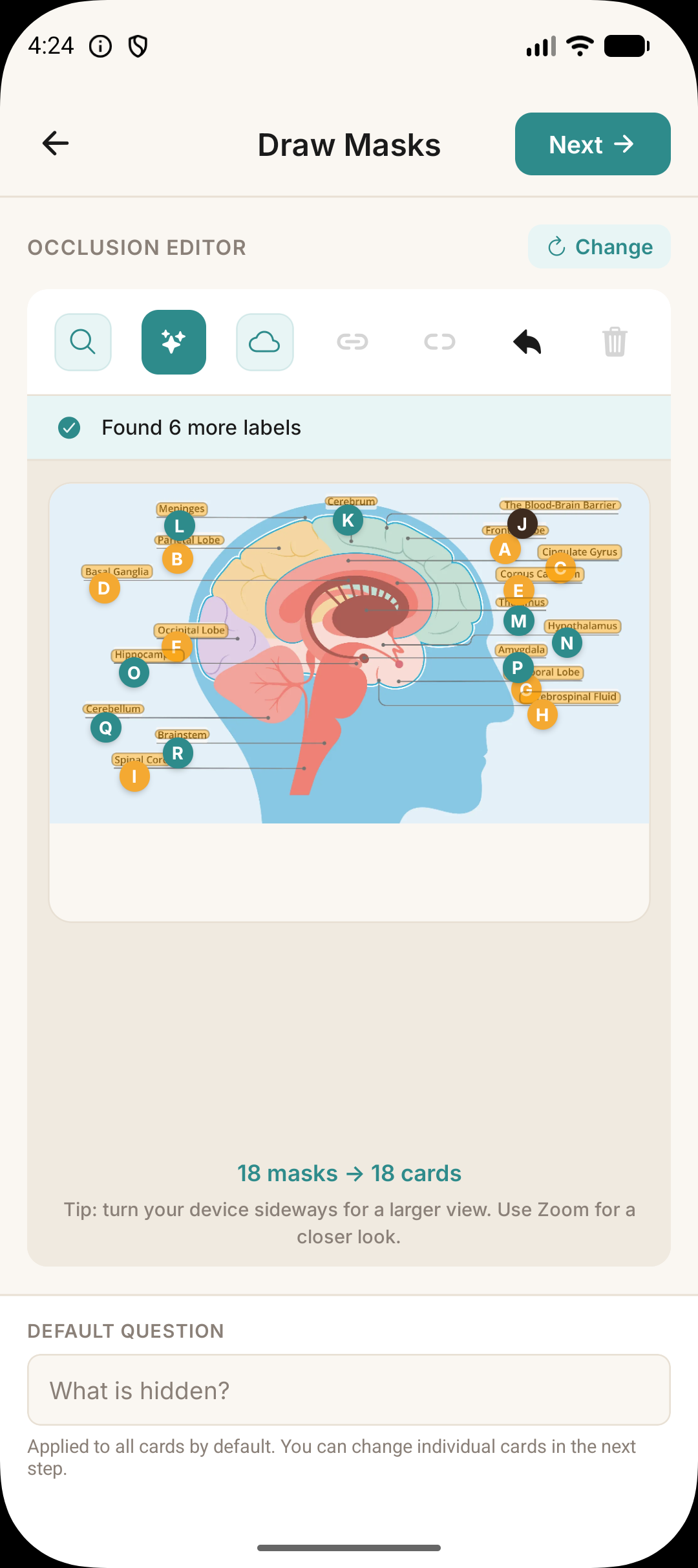 Aven image occlusion flashcard screen with a covered diagram label